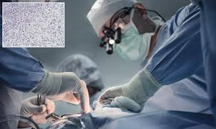 Doctor catches cancer from patient in first-of-a-kind case