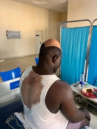 APC chieftain survives alleged assassination attempt in Abuja