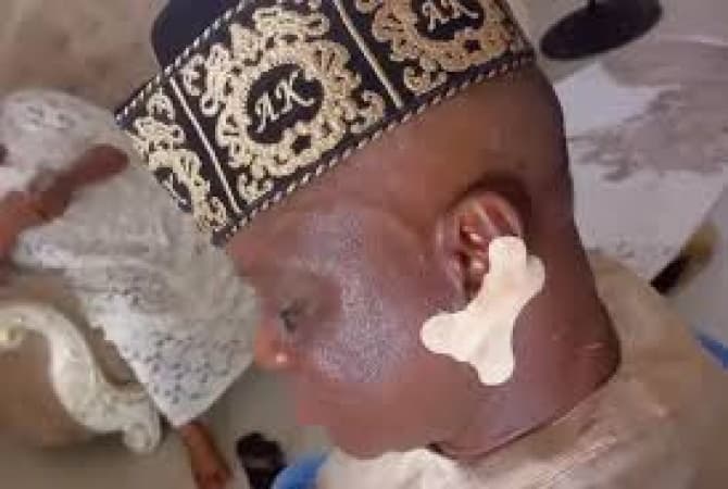 Traditional ruler molested during road flag-off by governor, lands in hospital