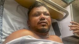 How lone survivor of Air India crash that killed 241 people escaped death — Police