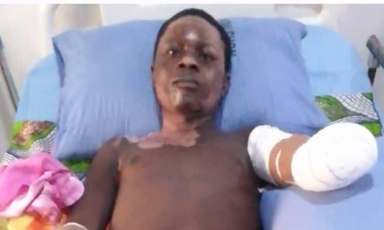Poly student survives electrocution, loses hands