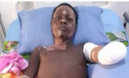 Poly student survives electrocution, loses hands