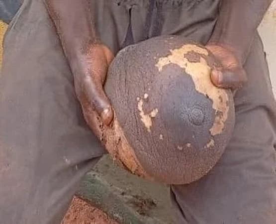 Man arrested with fresh human breast in Anambra
