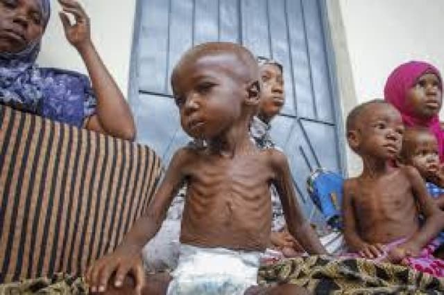 51.9 per cent of Kano children stunted by malnutrition ? UNICEF
