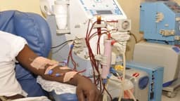 Dialysis cost reduction: Nephrologists cry out over exclusion of children