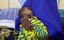 Japa: Nigeria’s malnourished children battling for breath in strained wards
