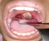 Diphtheria outbreak claims 10 lives in Niger State