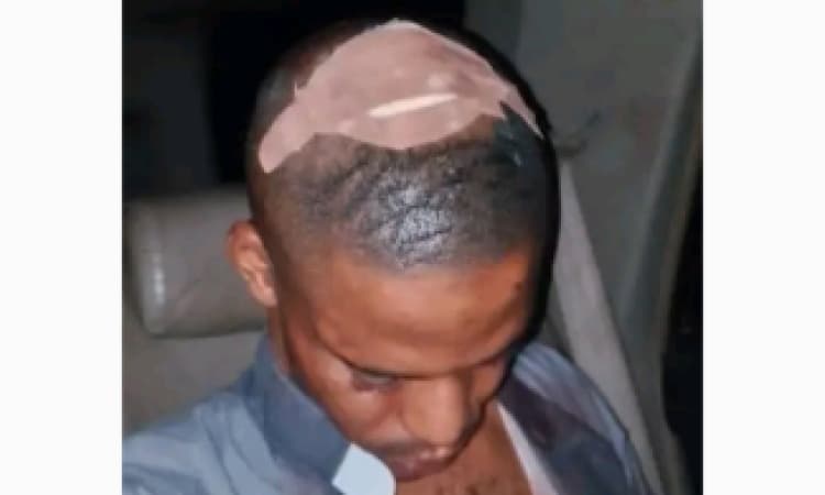 My ordeal in the hands of naval officers: How they tore my clothes and burst my head at Anambra checkpoint — Priest