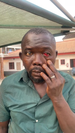 NAS member detained, assaulted by police in Edo state