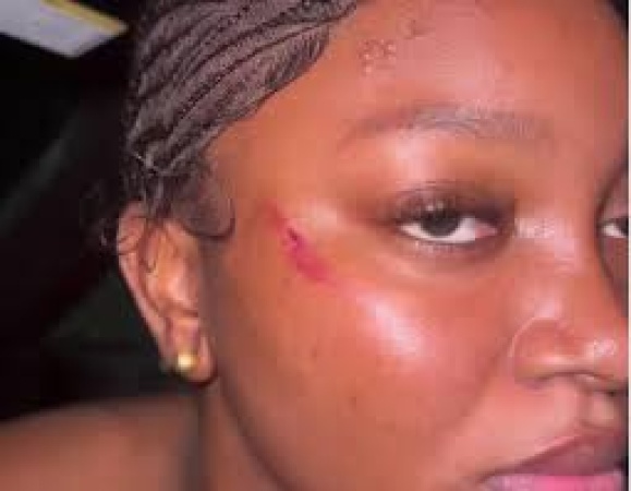 ‘He used his gun on me’ — Papaya Ex speaks out on alleged Police assault