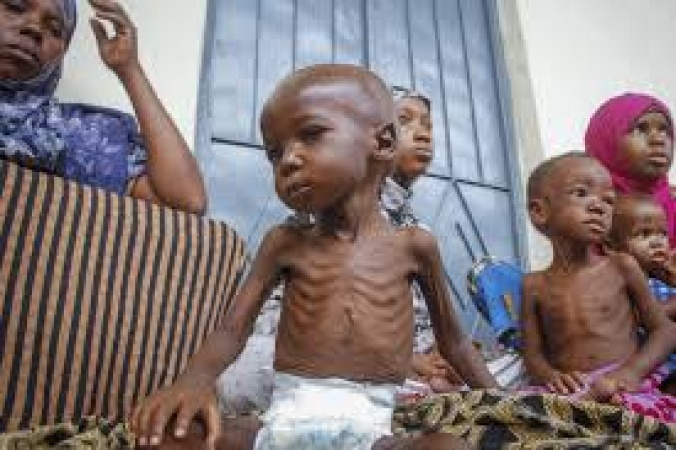 Insecurity: 6.4 million Nigerian children suffer acute malnutrition in north
