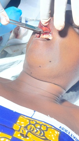 Wife on danger list, father narrowly escapes death as hoodlums unleash violence on Enugu family