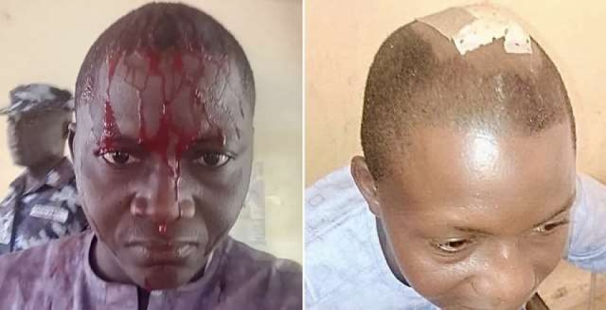 MRA condemns assault on journalist, demands immediate investigation and accountability