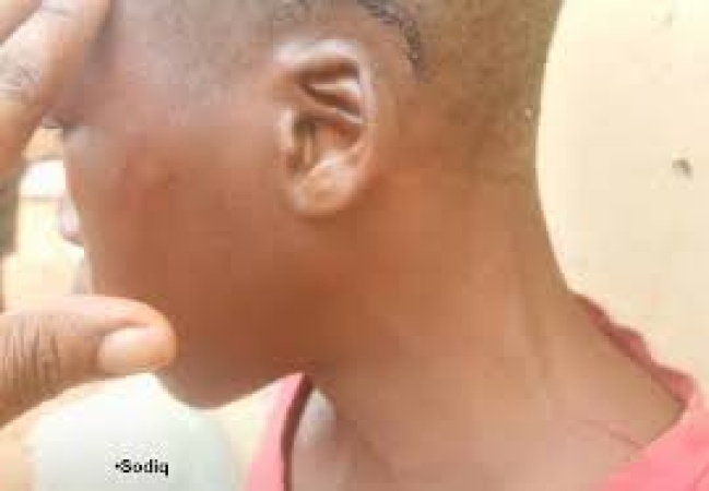 Outrage after security guard smashes 13-yr-old son’s head against toilet’s water closet