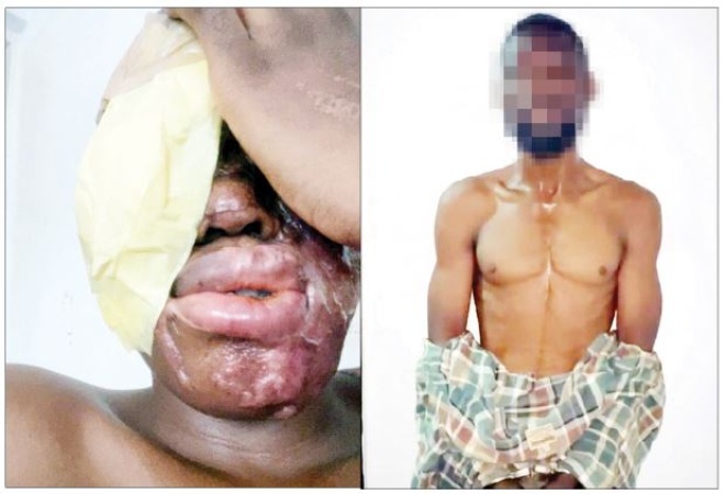 I got N500,000 to bathe spa worker with acid — Suspect
