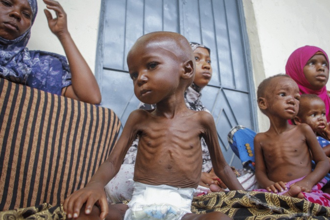 Benue faces worsening child malnutrition crisis — Official