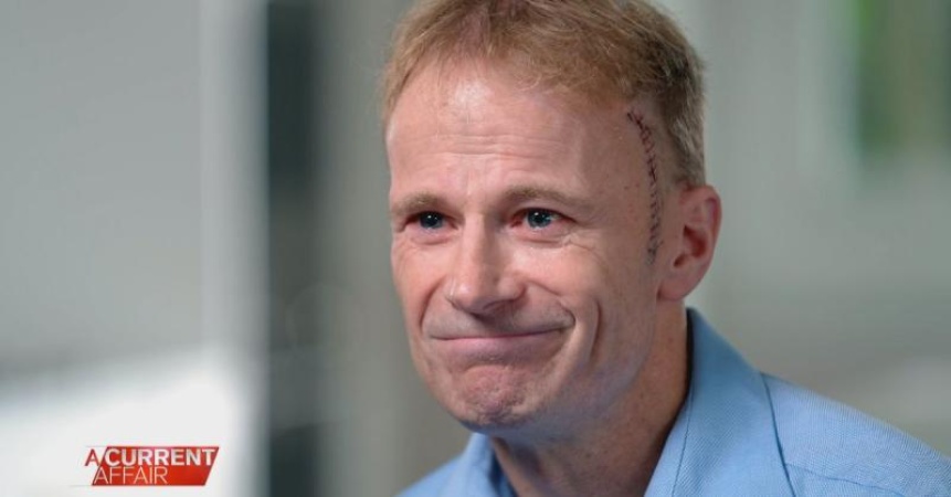Australian doctor who underwent 'world-first' brain tumour treatment dies 