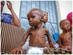 Malnutrition: A national wake-up call