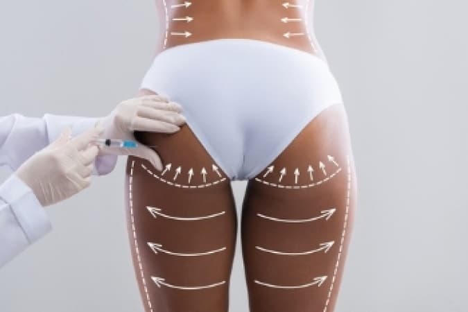 UK bans Brazilian butt lift advertisements