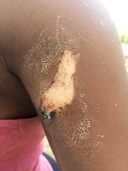 Tailor burns teenage customer with hot iron over clothing dispute