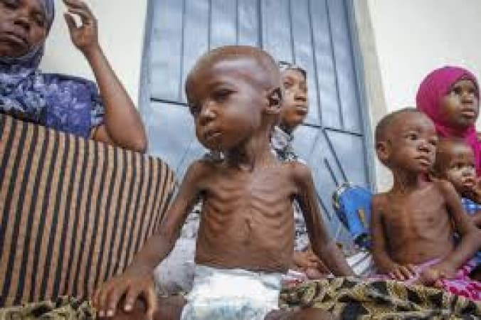 51.9 per cent of Kano children stunted by malnutrition ? UNICEF