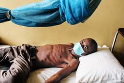 Tuberculosis killed 1.23 million globally in 2024 — WHO