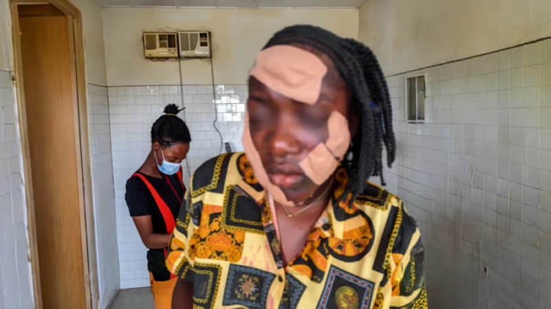 Outrage as angry woman slashes face of teenage girl who rejected husband's advances