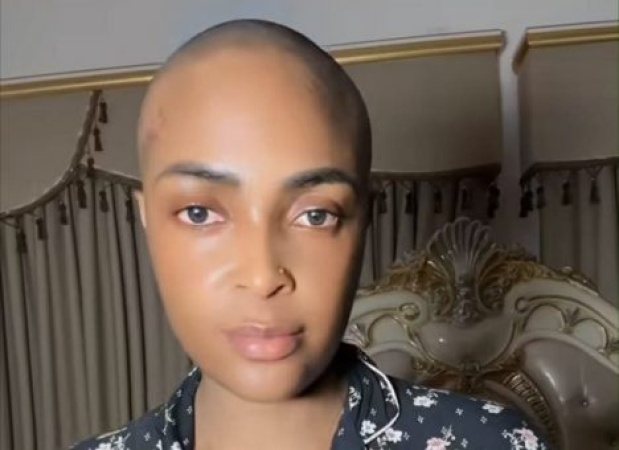 Why I can't share my cancer diagnosis evidence online — Blessing CEO