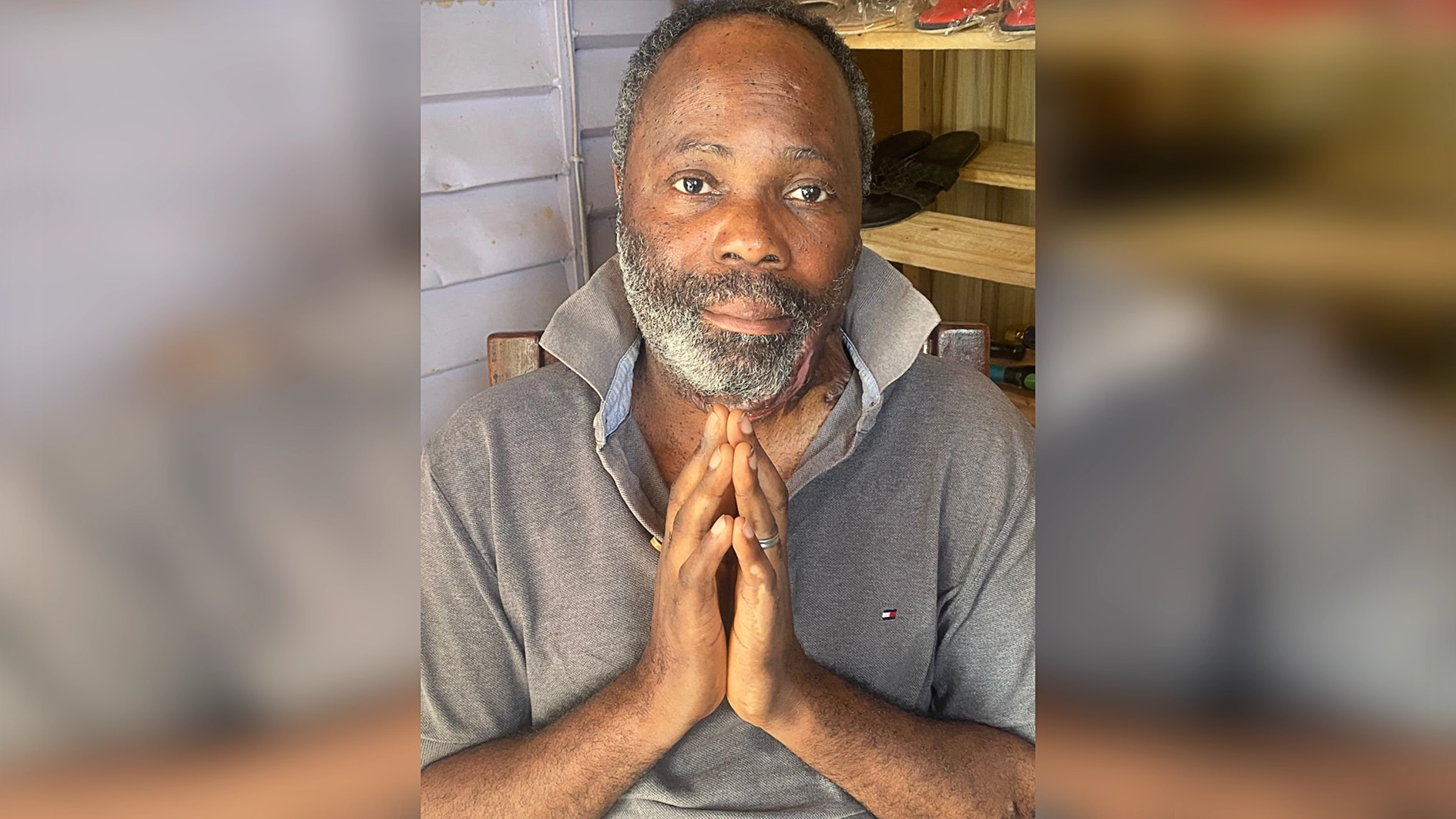 Man seeks N18m public support for eye surgery, alleges negligence at UCH